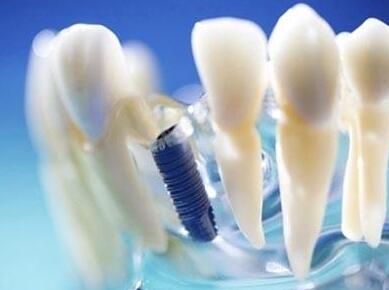 影响牙齿修复价格的因素有哪些