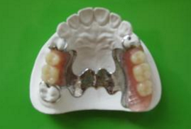 活动假牙护理指南