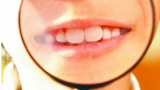 牙齿不整齐的原因是什么